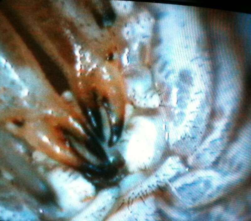This is a picture of a Harvestman Opiliones mouth at 200x magnification. I took this photo myself using an Eyeclops Bionicam. It is not a screen capture of a TV program or other copyrighted material.